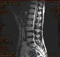 Компьютерная томография поджелудочной железы в ульяновске